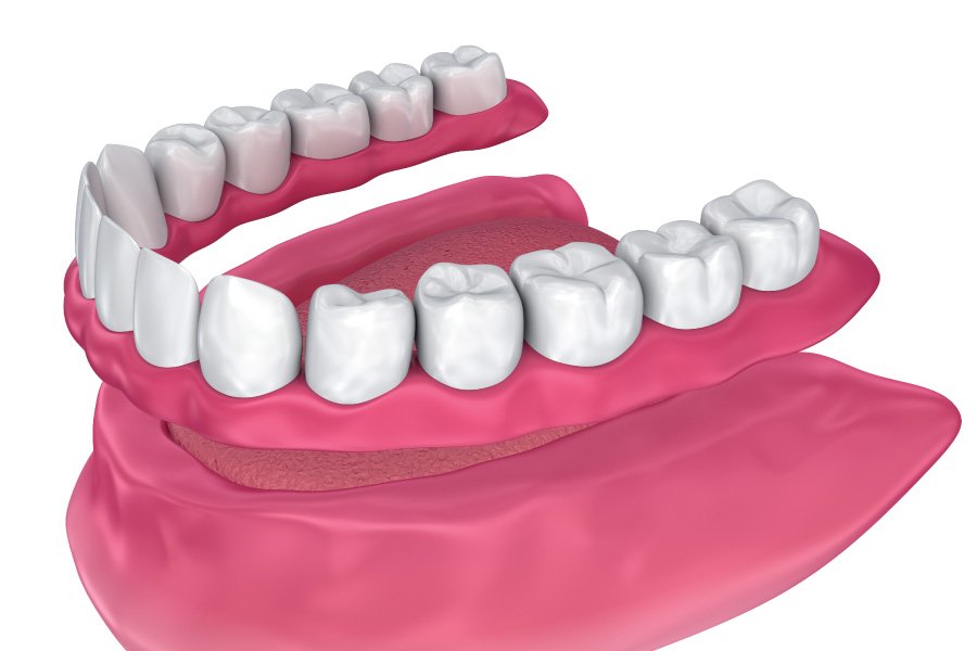Riverside IMmediate Dentures
