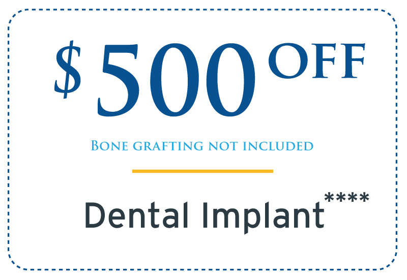 $500 Off Dental Implant Riverside, CA
